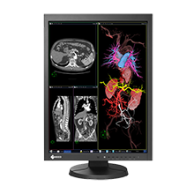 EIZO 21" MX215-BK Medical TFT LCD 420cd/m2, 1600x1200 Black Monitor