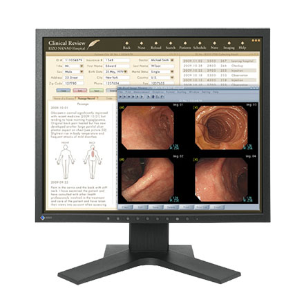 EIZO 19" MX191-BK Medical Color TFT DICOM Medical LCD 300cd/m2, 1280x1024 Monitor