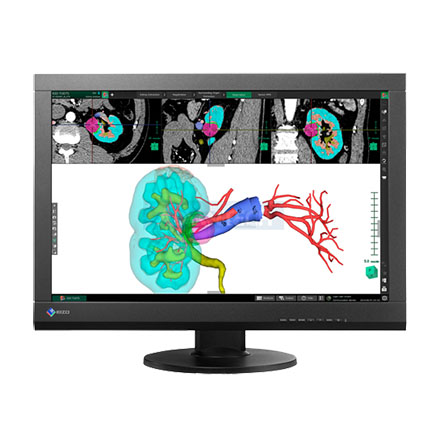 EIZO 24.1" MX242W-BK Medical Wide Color TFT IPS DICOM Medical LCD 350cd/m2, 1920x1200 Monitor