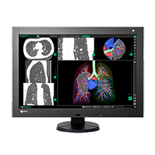 EIZO 29.8" RX440-BK RadiForce 4MP Medical LCD 1,000cd/m2, 2560X1600 Monitor
