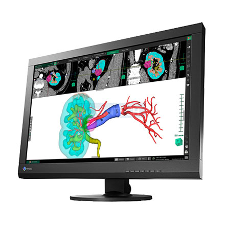 EIZO 24.1" MX242W-BK Medical Wide Color TFT IPS DICOM Medical LCD 350cd/m2, 1920x1200 Monitor